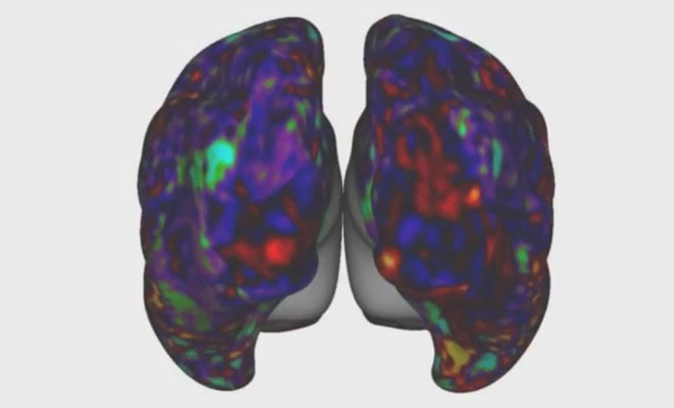 Image shows an fMRI brain scan.