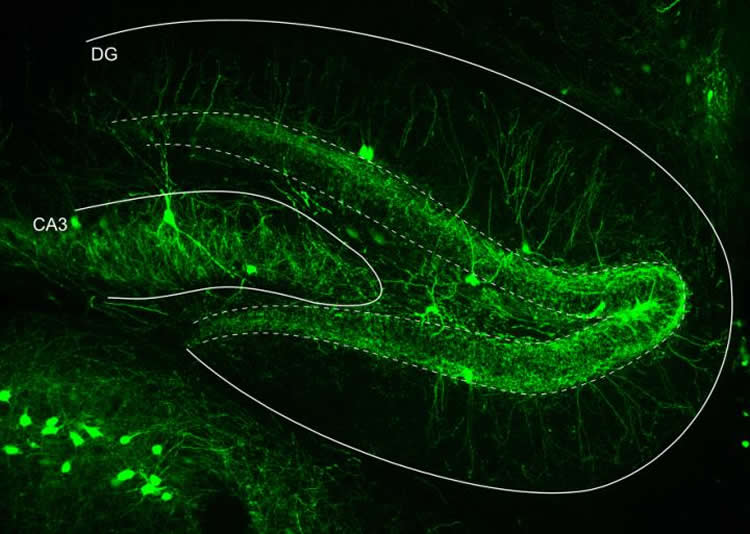 Image shows the hippocampus.