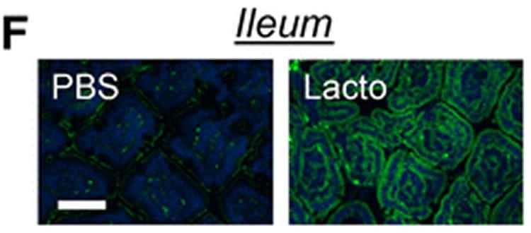 ileum cells.