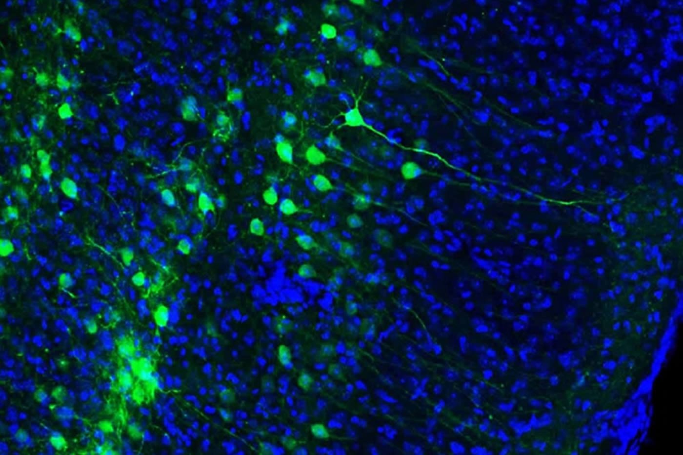 medial entorhinal cortex