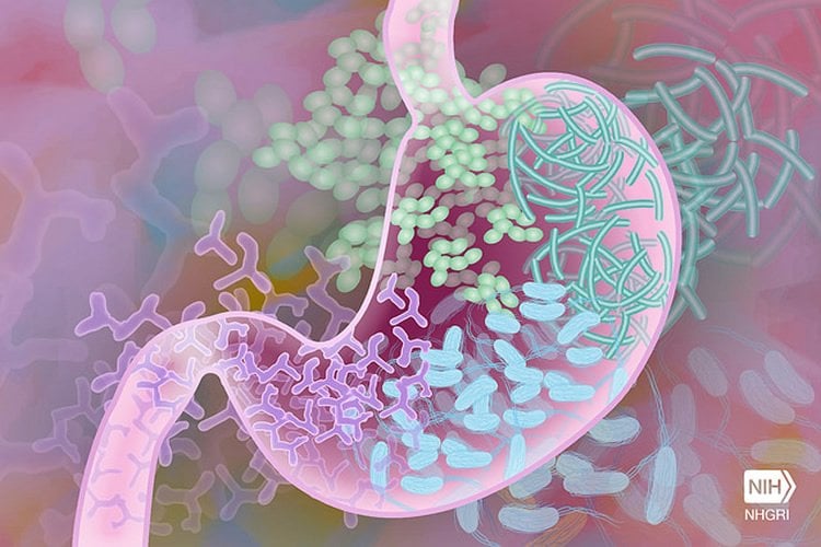 Image shows a drawing of a stomach and bacteria.