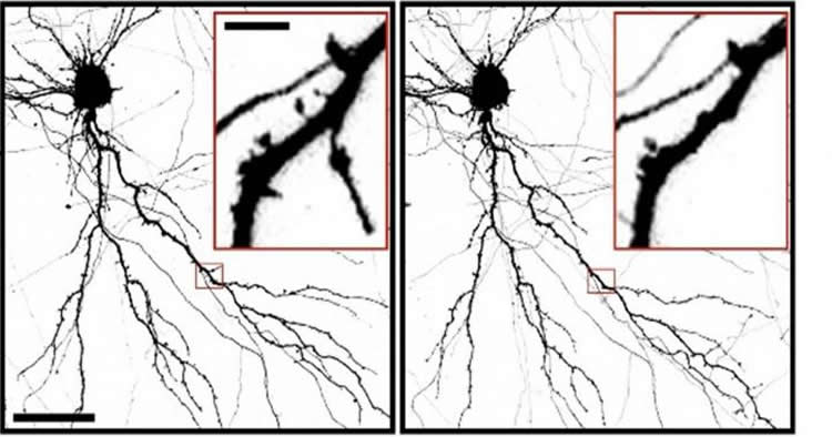 Image shows neuron spines.