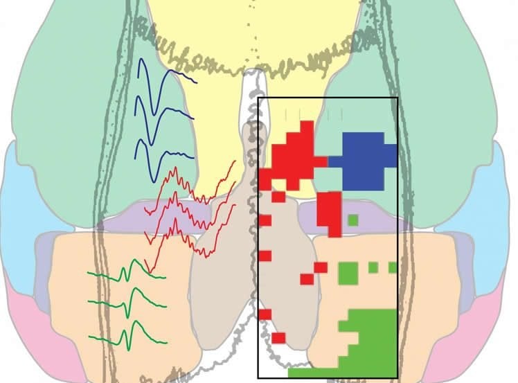 Image shows a brain map.