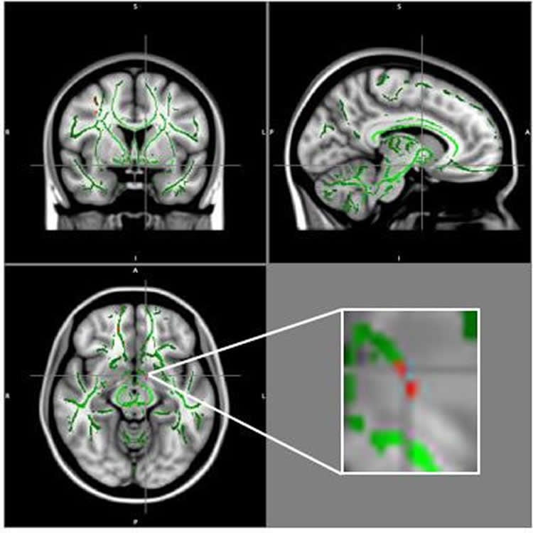 Image shows a brain scans.