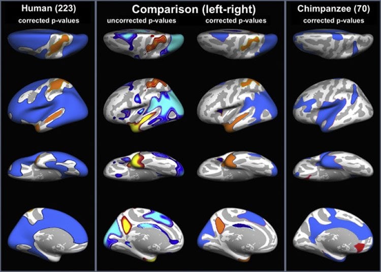 Image of brain scans.