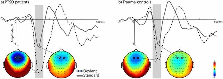 Image shows brain networks.