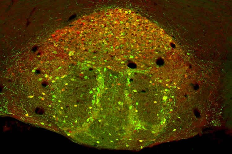 Image shows the interpeduncular nucleus of a mouse brain.