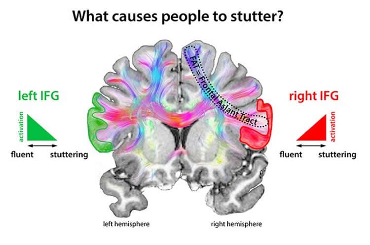 Image shows a brain slice.