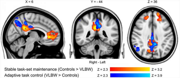 brain scans