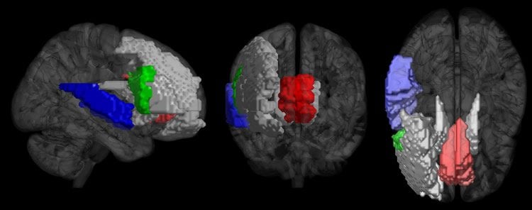 brain scans