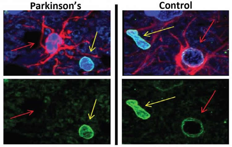 astrocytes