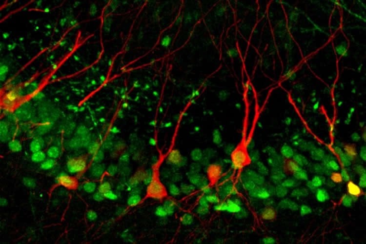 ca3 neurons