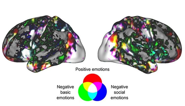 brain scans