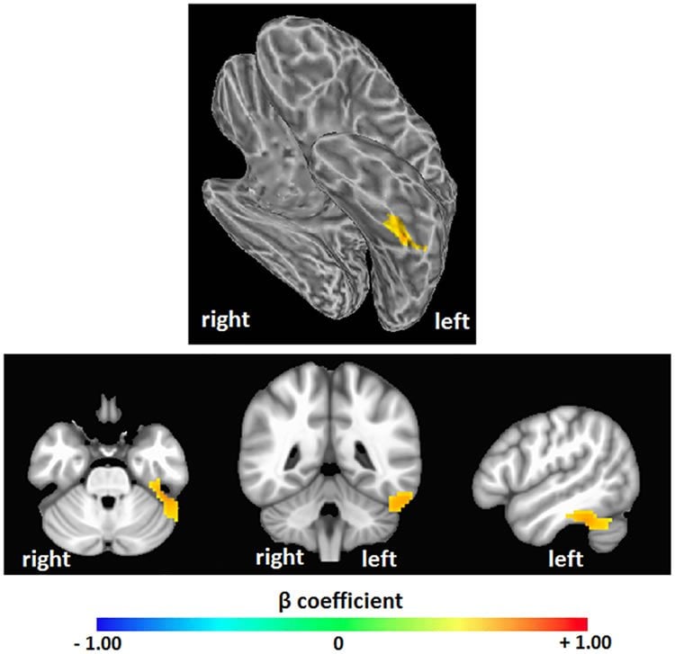 Image shows brain scans.