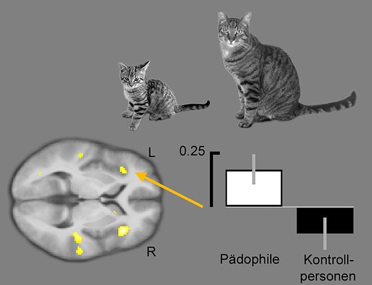 cat and brain scan