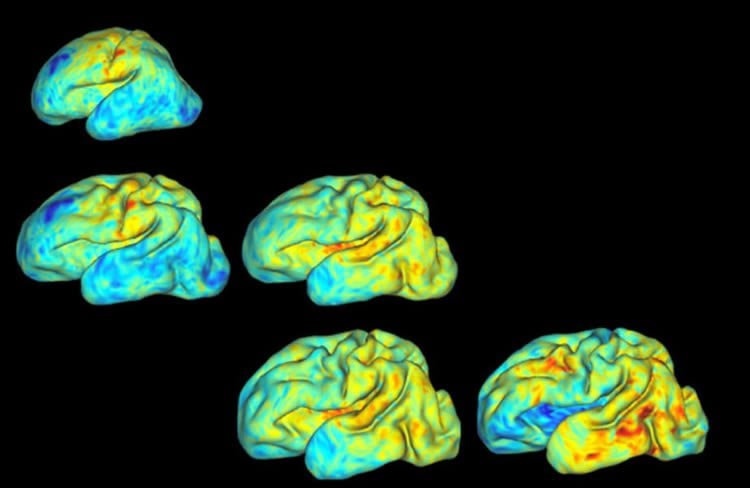 brain maps