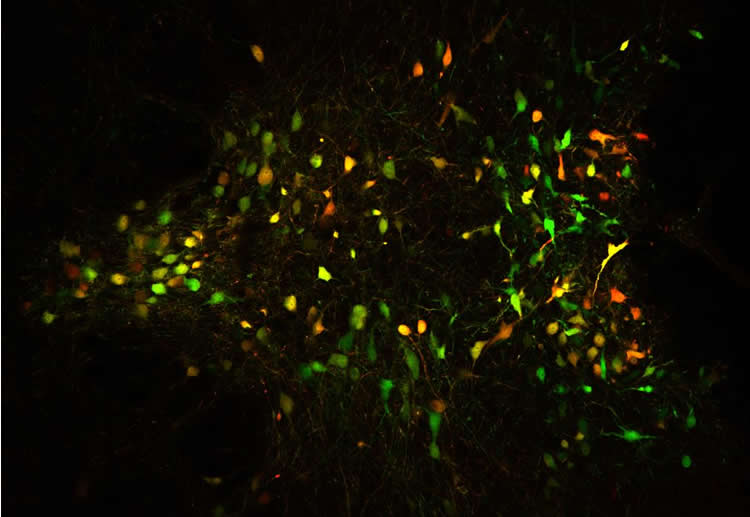 serotonin neurons