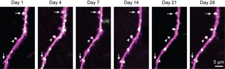 Long-Lasting Brain Proteins Offer Clues to How Memories Last a Lifetime ...