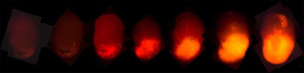 organoids