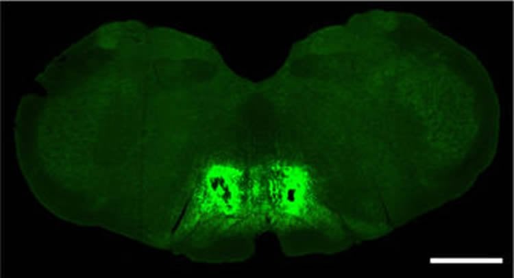 frontal lobe brain slice