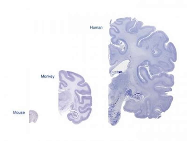 cerebral cortex slices of mice, humans and monkeys