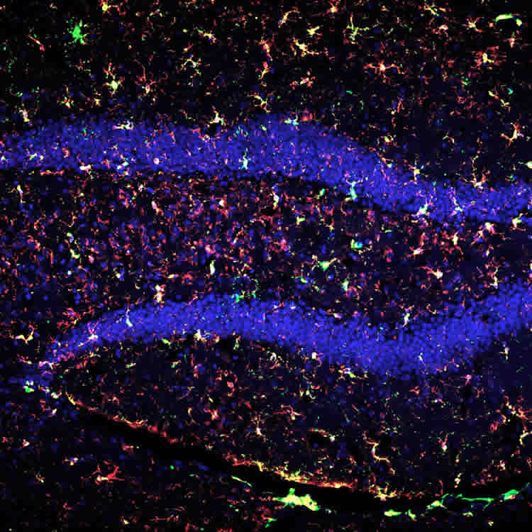 microglia