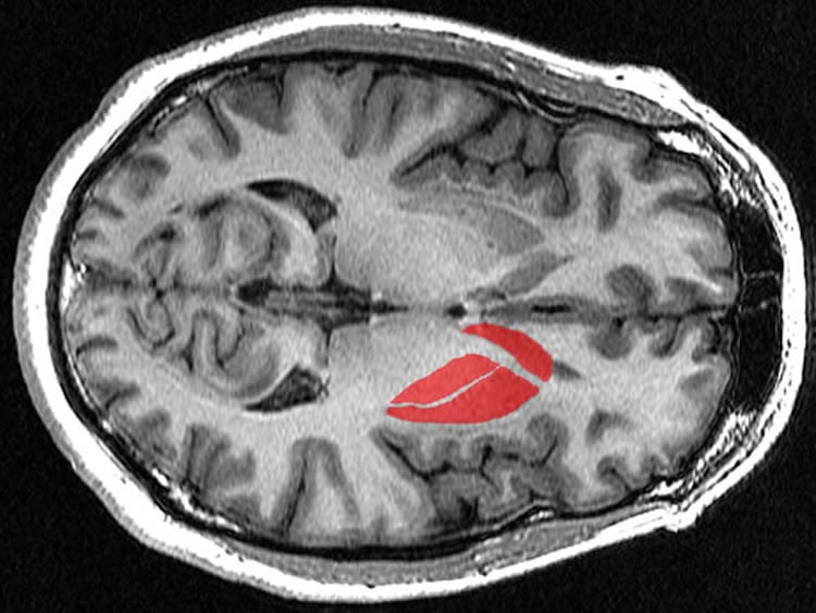 striatum brain