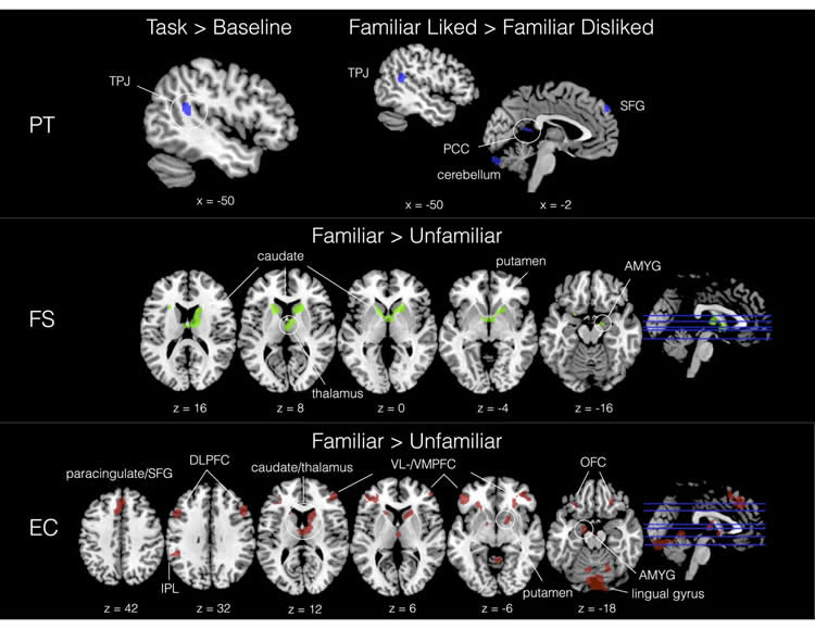 brain scans taken while people listened to music