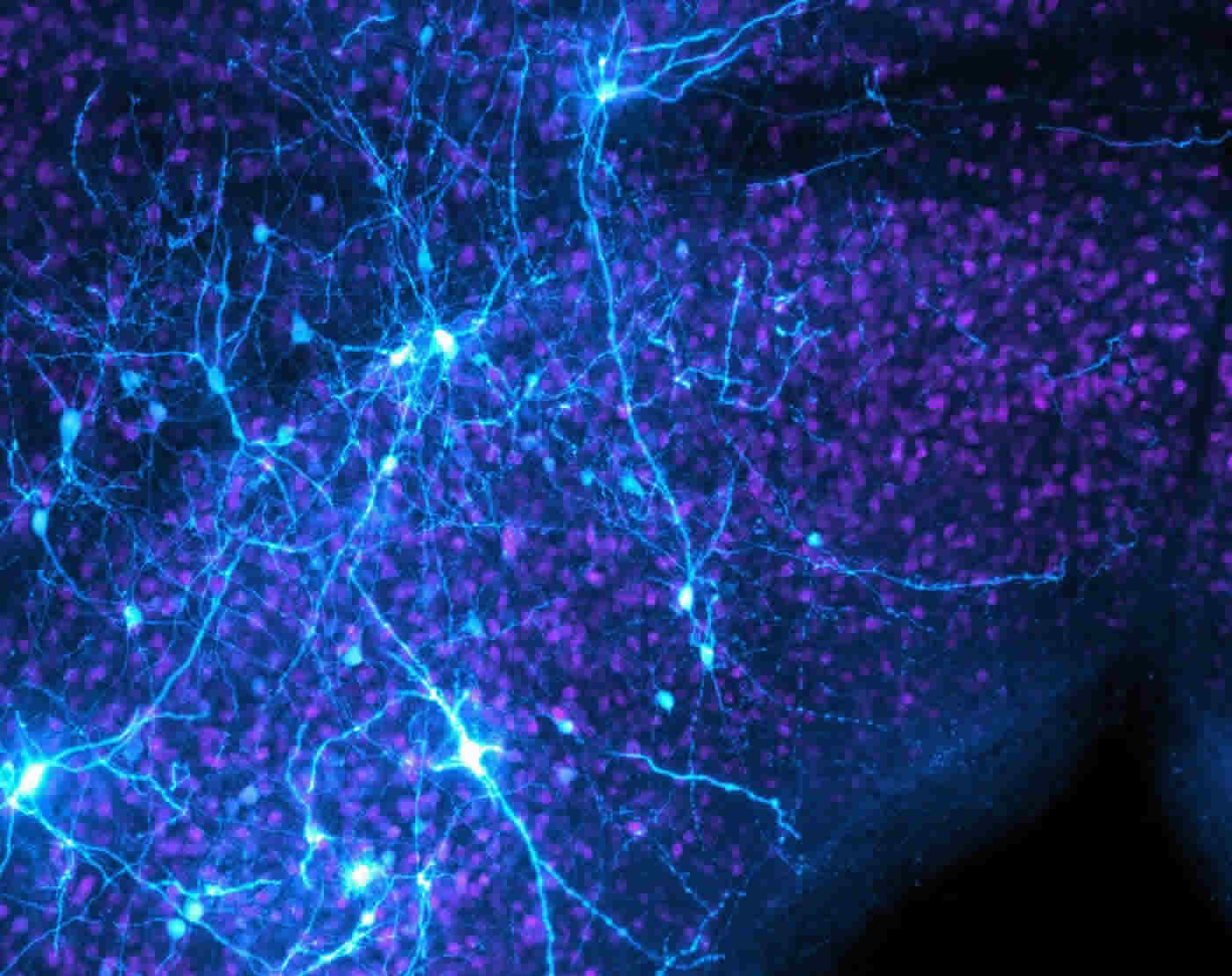 midbrain neurons