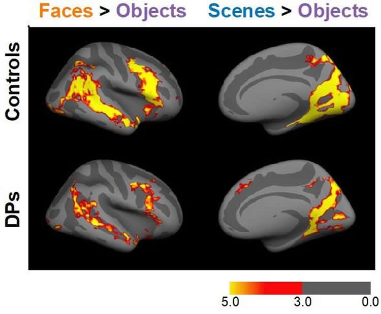 brain scans