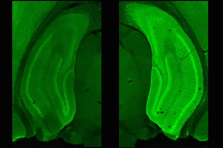 a stained hippocampus