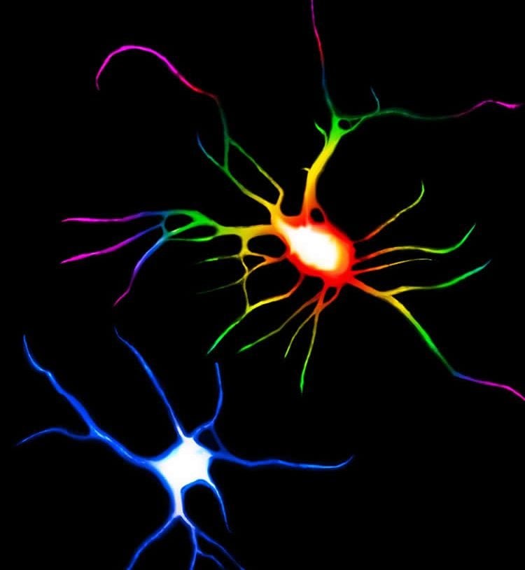 image shows neurons under psychedelics and ketamine