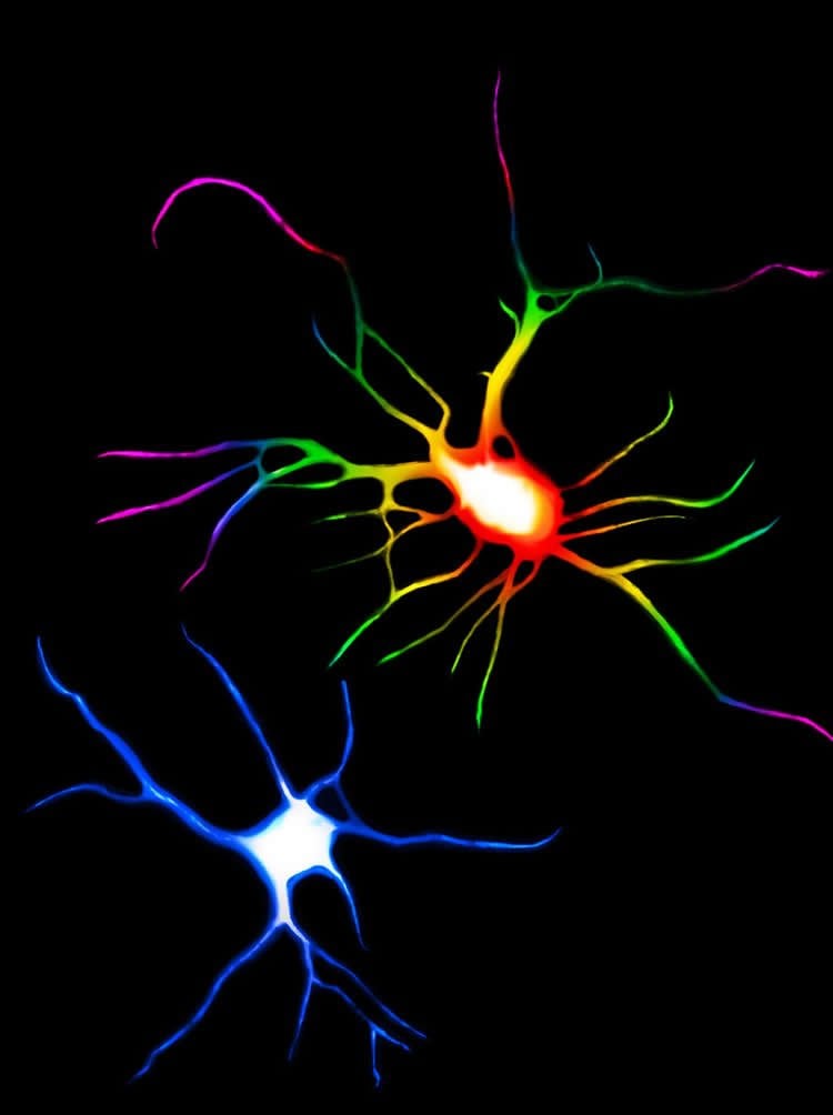 image shows neurons under psychedelics and ketamine