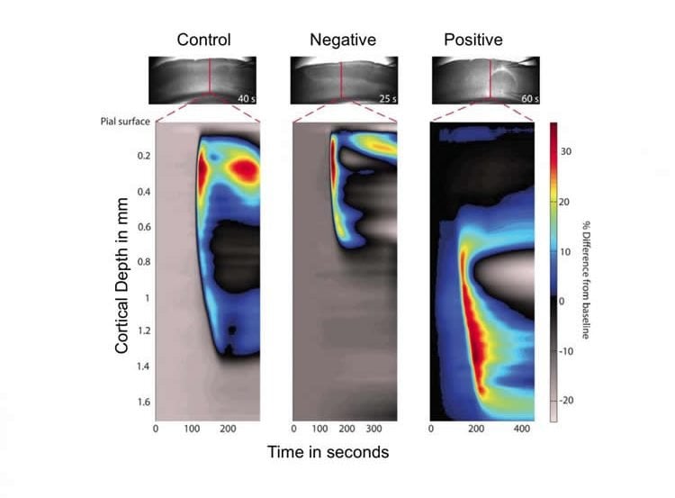 images show depolarization spreading in the brain