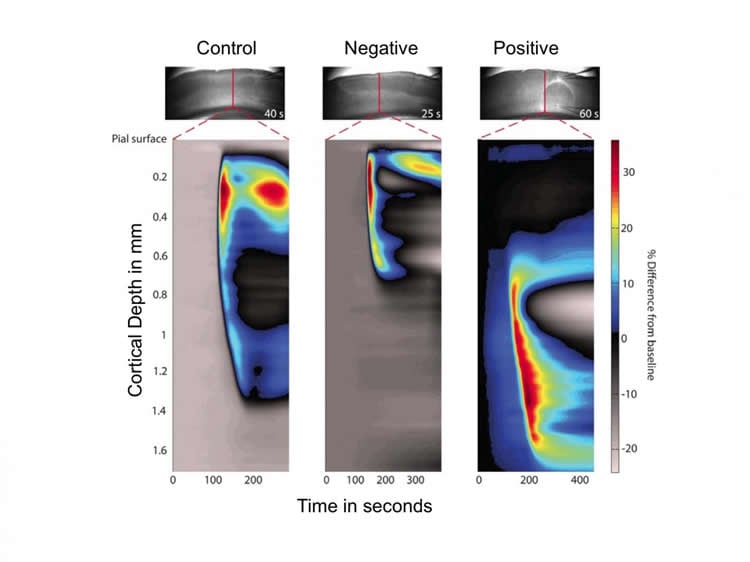 images show depolarization spreading in the brain