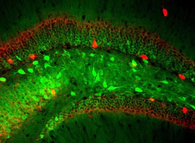 hippocampal neurons are shown