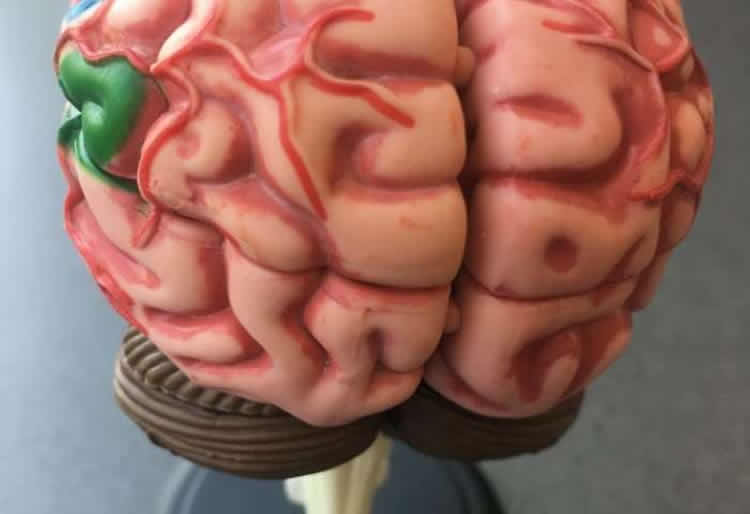 a brain is shown