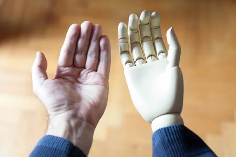 a prosthetic hand