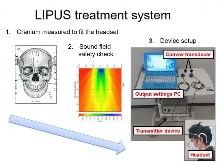 the LIPUS system