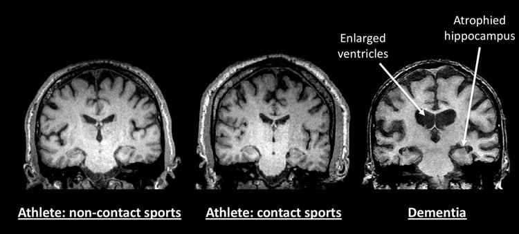 brain scans