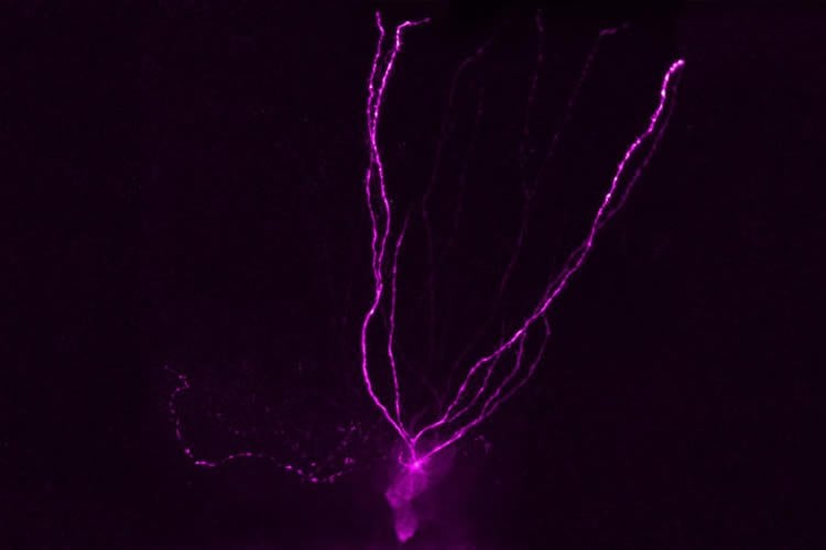 gaba neuron