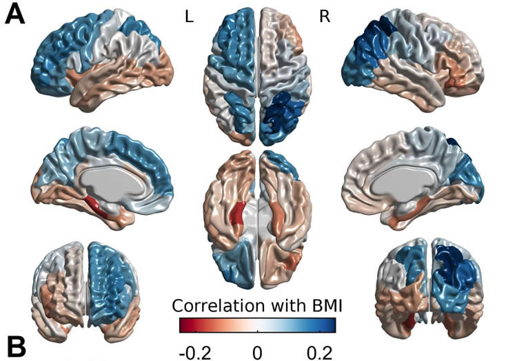 brain scans