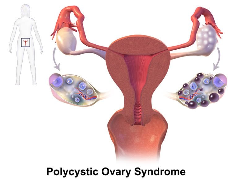 a diagram of the female reproductive system