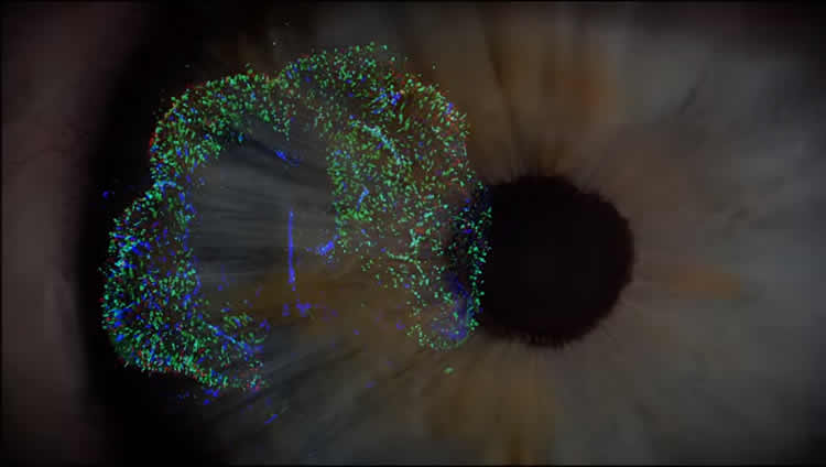 an eye and retinal cells