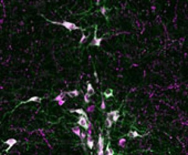 serotonin neurons