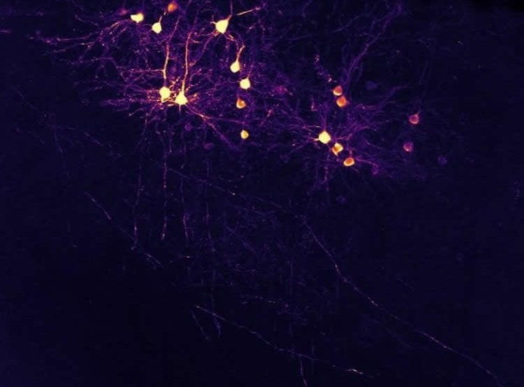 visual cortex neurons