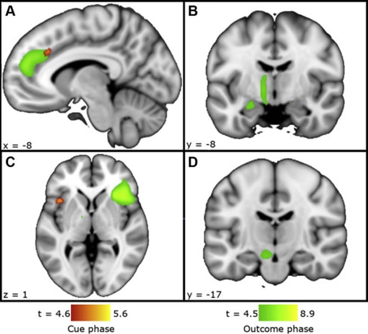 brain scans