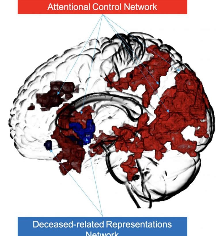 brain scan