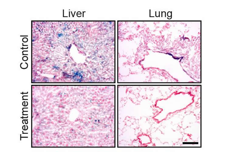 immune cells and organ slices