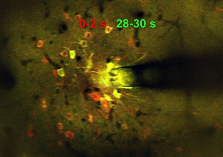 Electrical Neuron Splitting Single Multiple Neurology Concept Pulsing Stock  Video Footage by ©bobbigmac #350862580